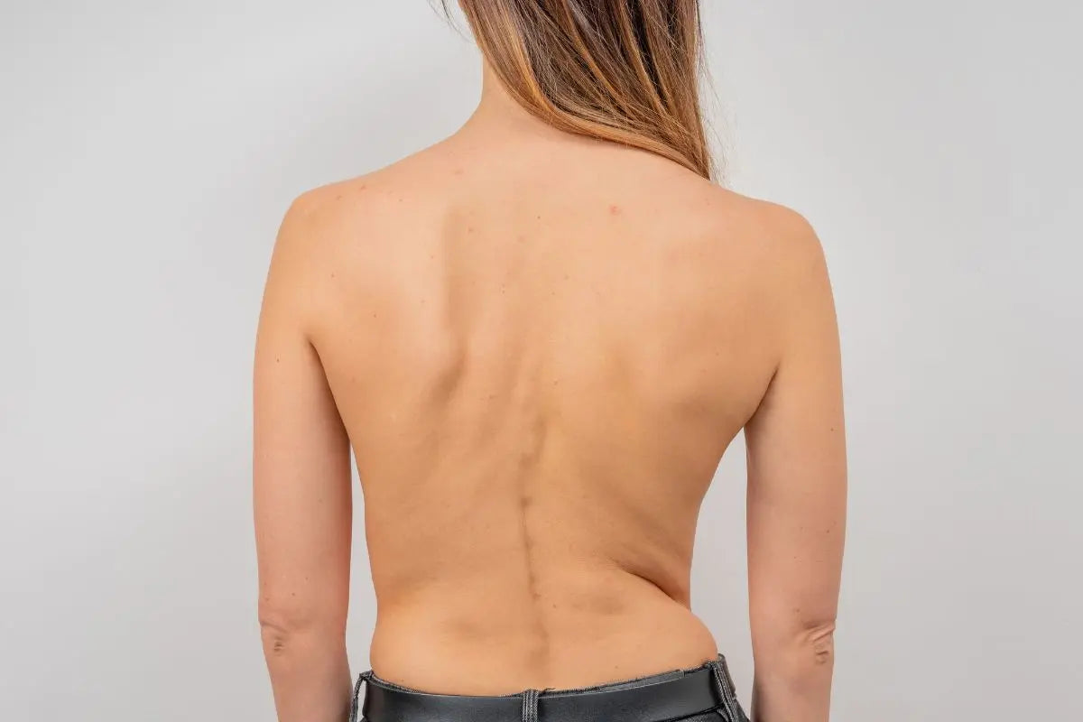 Les exercices de sport qu'on peut réaliser quand on a une scoliose
